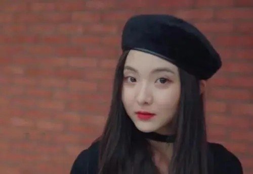 陈卓璇的脖子怎么回事儿？