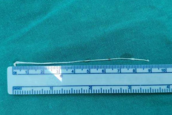 8mm是多少厘米,100mm是多少厘米？