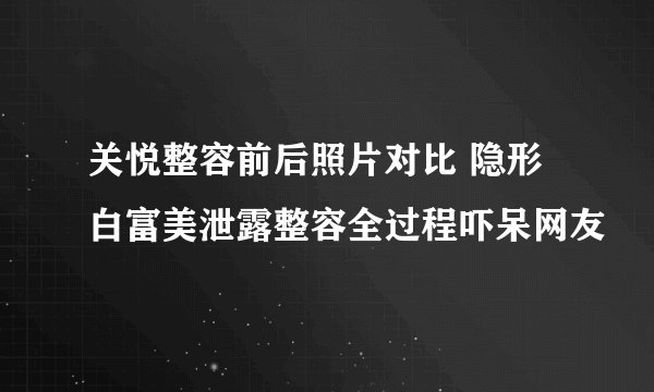 关悦整容前后照片对比 隐形白富美泄露整容全过程吓呆网友