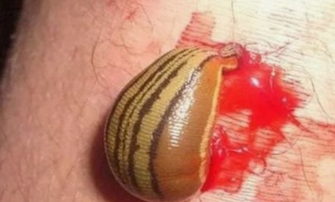 云南十大最毒虫子