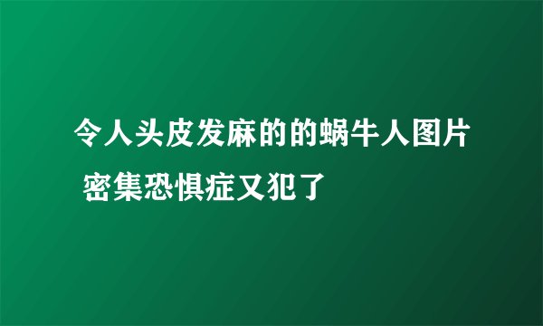 令人头皮发麻的的蜗牛人图片 密集恐惧症又犯了