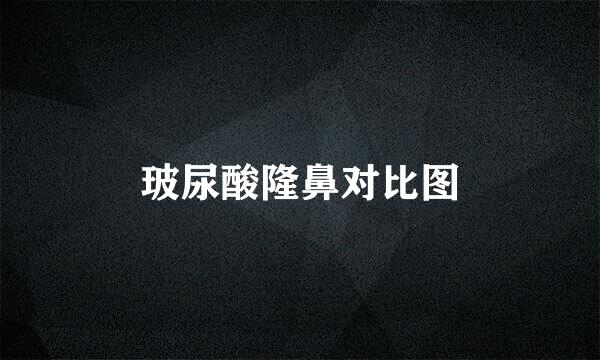 玻尿酸隆鼻对比图