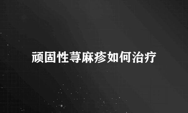 顽固性荨麻疹如何治疗