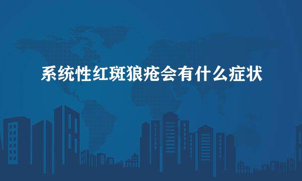 系统性红斑狼疮会有什么症状