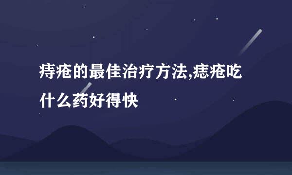 痔疮的最佳治疗方法,痣疮吃什么药好得快