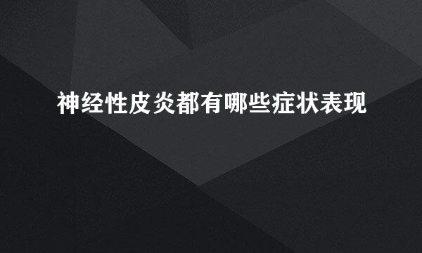 神经性皮炎都有哪些症状表现