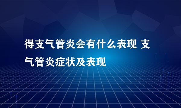 得支气管炎会有什么表现 支气管炎症状及表现