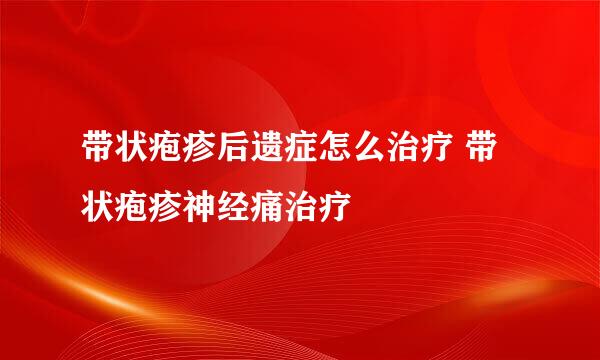 带状疱疹后遗症怎么治疗 带状疱疹神经痛治疗