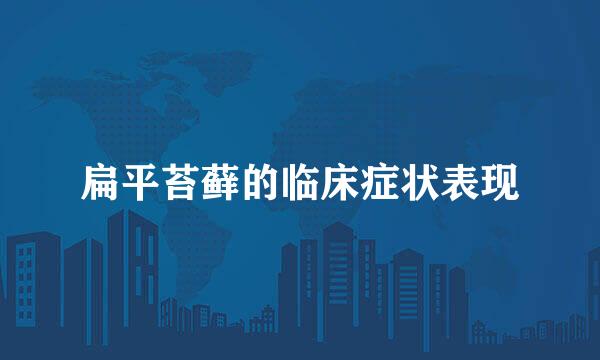 扁平苔藓的临床症状表现