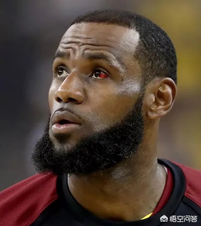 詹姆斯眼球都是血块，拉近镜头大家看到詹姆斯的眼睛之后，是什么感受？