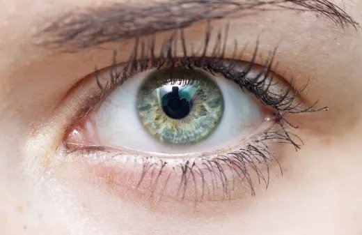 定点双眼皮优点