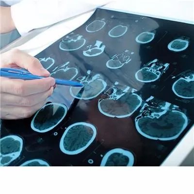 做脑电图多少钱