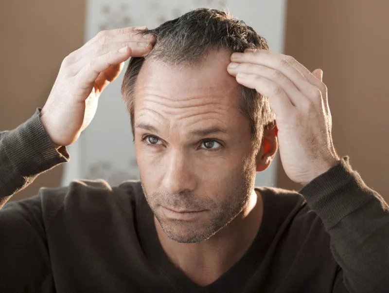 青年白发有哪些原因