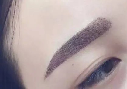 做双眼皮最好的医院是哪家啊