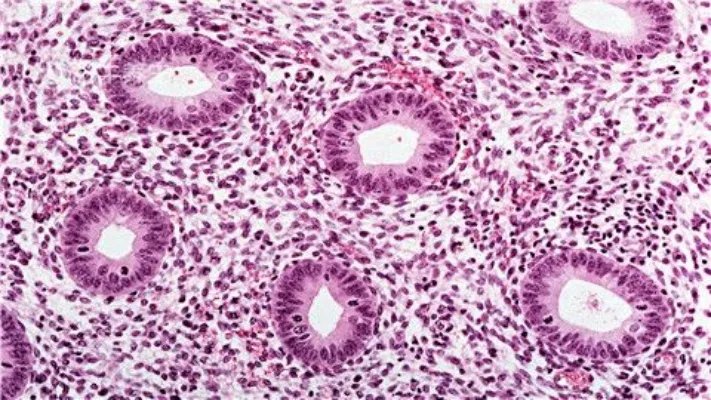 念珠菌如何治疗