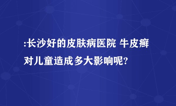 :长沙好的皮肤病医院 牛皮癣对儿童造成多大影响呢?