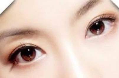 开眼角的价格要多少
