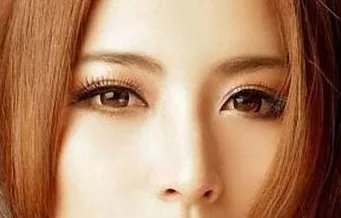 昆山割双眼皮哪儿好