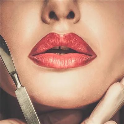 注射丰鼻唇沟多少钱