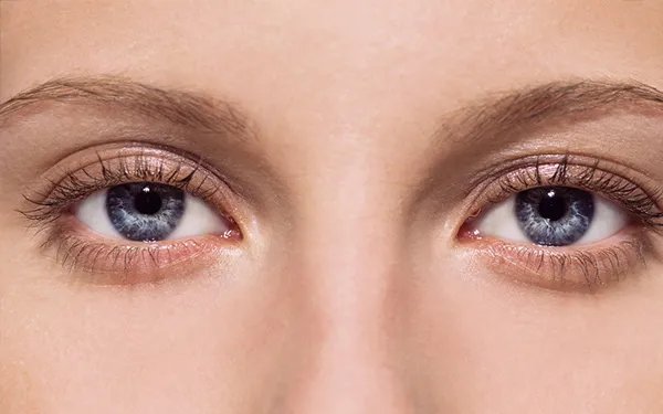 重庆开眼角哪几个整形医院口碑好