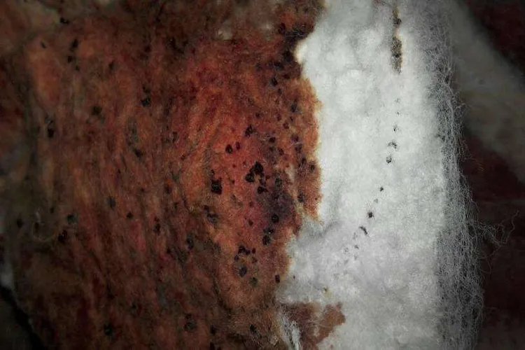 月经有渣渣图片