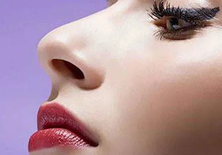 膨体隆鼻效果如何