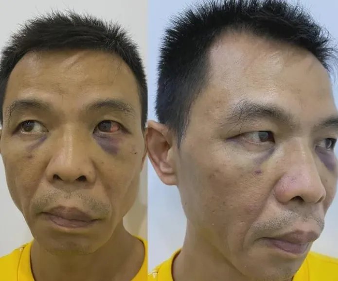 男子发文称被副局长锁在家中殴打，这副局长为何这狠？