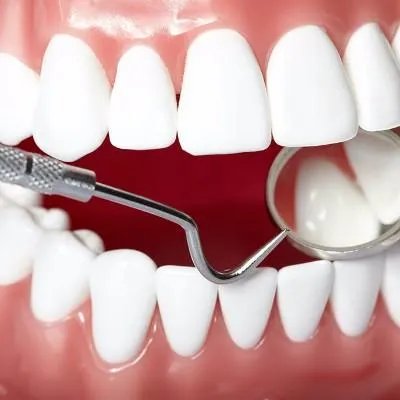 什么烤瓷牙最好