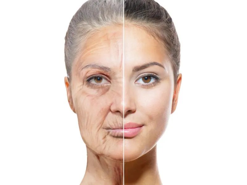 如何去嘴角皱纹