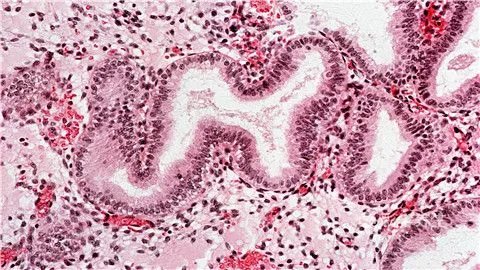 念珠菌如何治疗