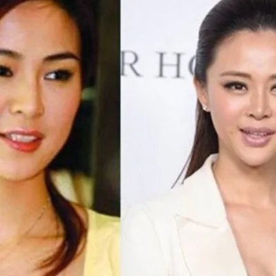 关悦整容像关之琳是真的吗？ 整容前旧照与整容后对比照曝光