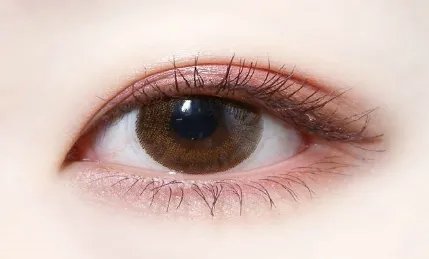 开内眼角大概多少钱