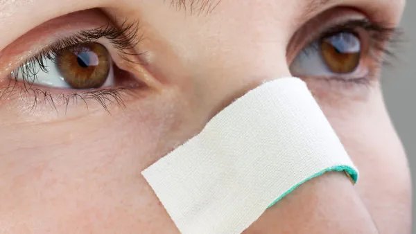 消除黑眼圈的最快方法