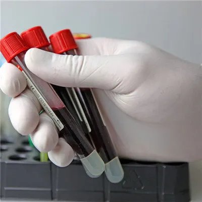 沙门菌感染怎么护理？