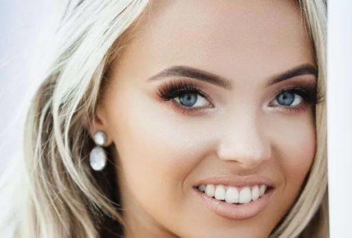 去鱼尾纹哪里做的好