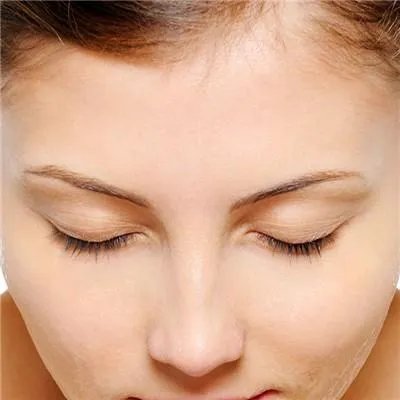 玻尿酸瑞兰价格