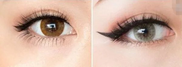 成都去眼袋好的医院是哪家