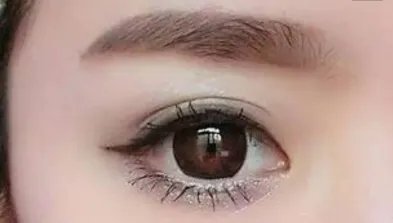 2021兰州时光激光整形美容医院全切双眼皮价格表(价目表)怎么样?