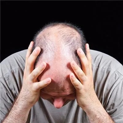 晒太阳后皮肤痒怎么办