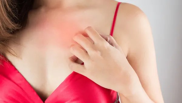 疥疮用什么药好的快