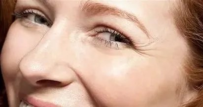 去眼角细纹妙招