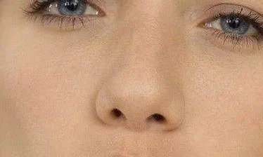 注射隆鼻修复术后注意什么