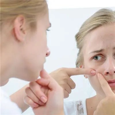 激光如何治疗青春痘