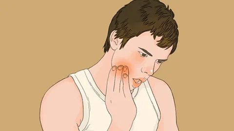 芬必得治牙疼是怎么回事