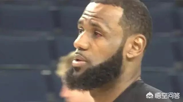 詹姆斯眼球都是血块，拉近镜头大家看到詹姆斯的眼睛之后，是什么感受？