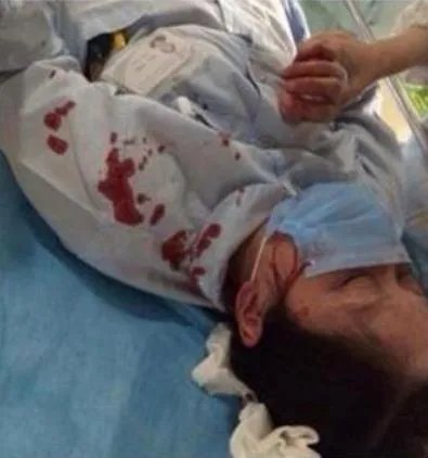 北京女医生去世什么情况 事件始末详情及现场画面曝光