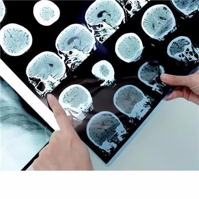 做脑电图多少钱