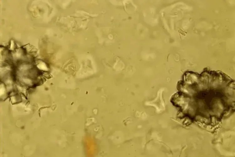 大黄显微镜观察鉴别图