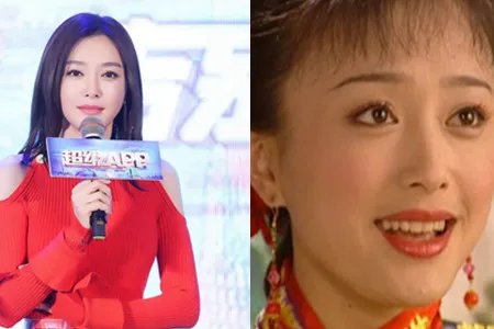 秦岚出入美容诊所 难道对自己的形象还不满意