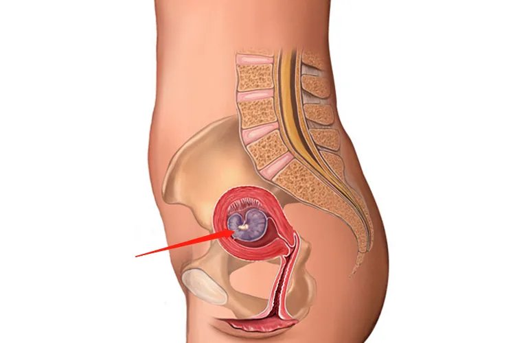怀孕的子宫和正常子宫的区别图片